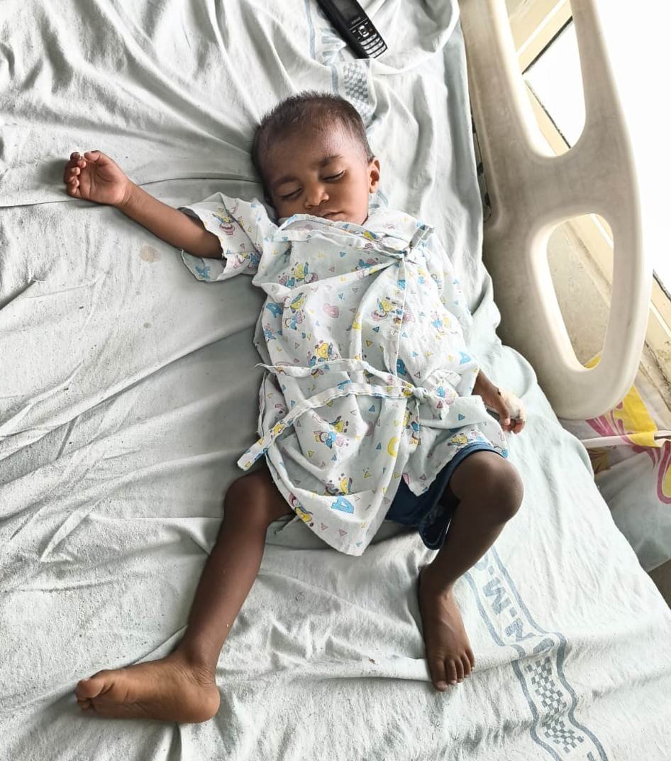 RBSK Free Heart Surgery for Child in Agra