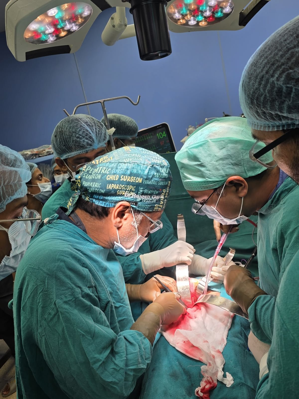 Complex pediatric surgeries successfully performed at SN Medical College Agra